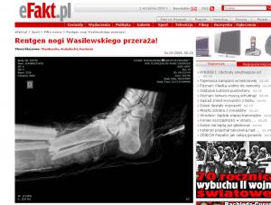 Rentgen nogi Wasilewskiego przeraża!